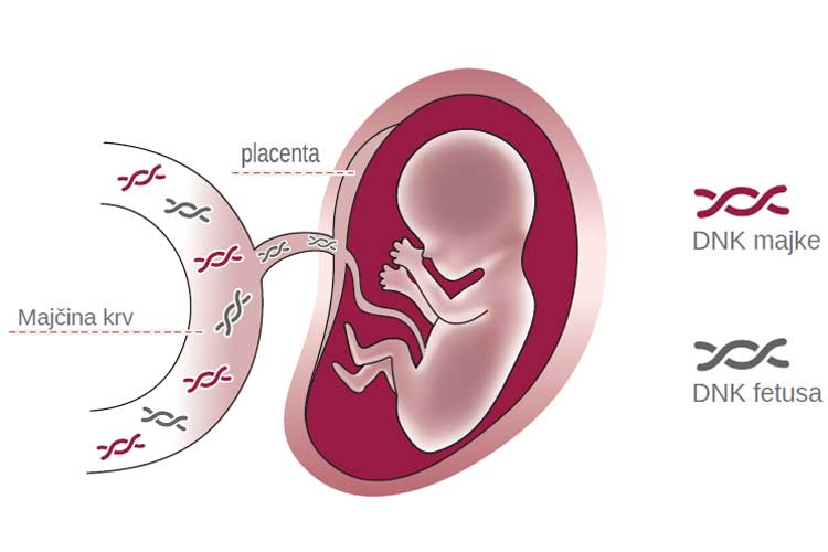 Kompletan Neinvazivni Prenatalni Test